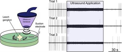 A review of the bioeffects of low-intensity focused ultrasound and the benefits of a cellular approach